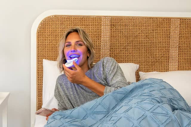 The at-home teeth whitening kit costs around £2 per treatment, offering an affordable alternative to professional whitening.