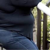 Obesity admissions to hospital are higher in Luton that the rest of the East England region