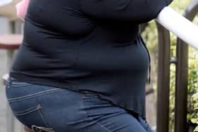 Obesity admissions to hospital are higher in Luton that the rest of the East England region