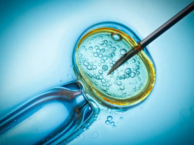 Currently Luton offers three rounds of IVF treatment, compared to Bedfordshire and Milton Keynes which both only offer one round