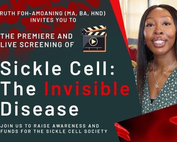 Sickle Cell: The Invisible Disease Charity Event 