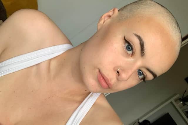 Brave Lauren Faulkner who has had her head shaved to raise money for Young Lives v Cancer, a charity that as helped her since being diagnosed with Hodgkin Lymphoma in May