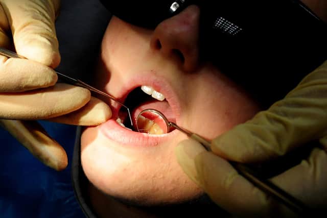 There has been a rise in the number of children in Luton needing hospital treatment for tooth decay