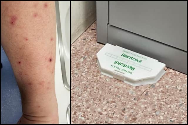 Bedbug bites, and a trap in the hospital. Picture: Submitted