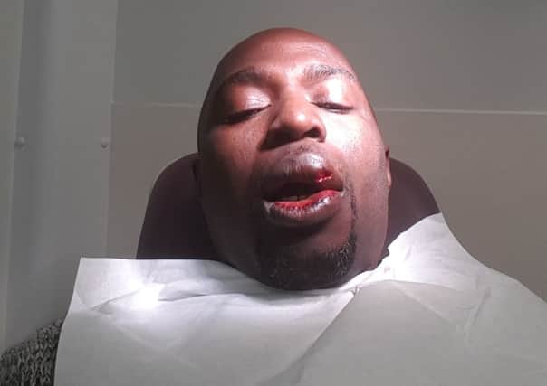 Henry Ifesi after the attack
