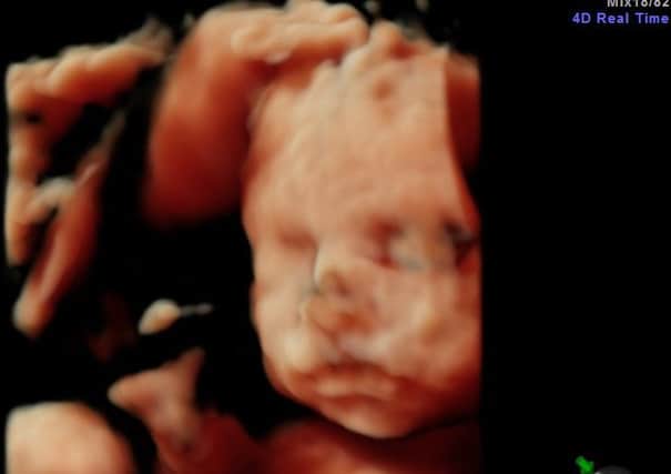 The incredible 3D scan showing the perfect features of baby Smith